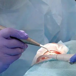 恵庭市の予防歯科・定期検診