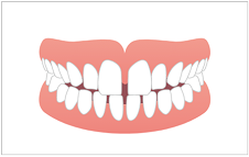 恵庭市のライオン歯科クリニックの矯正歯科