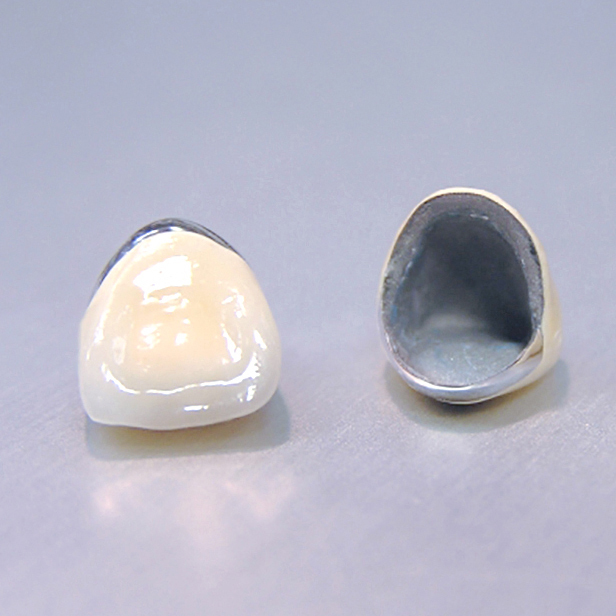 恵庭市の審美歯科(白い詰め物・被せ物)