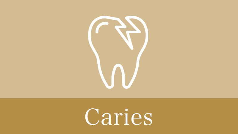 恵庭市の虫歯の治療