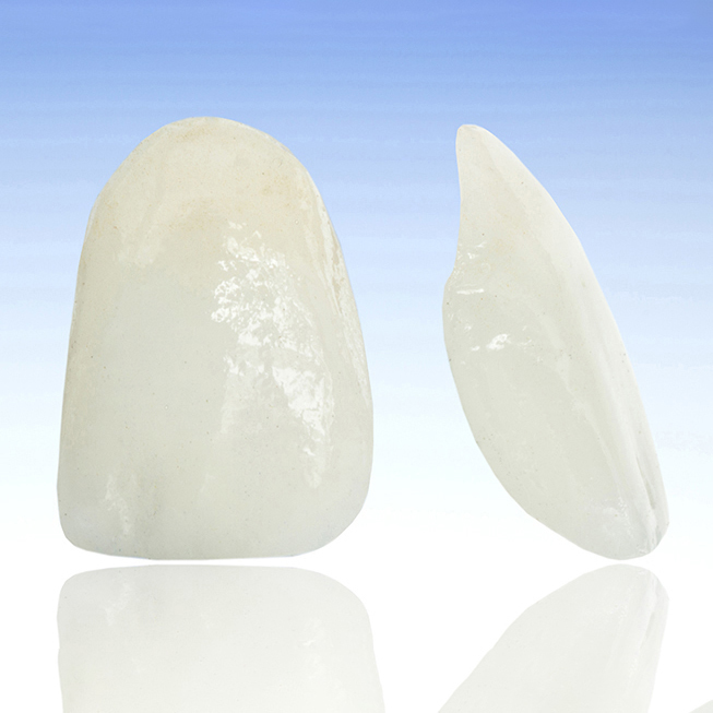 恵庭市の審美歯科(白い詰め物・被せ物)