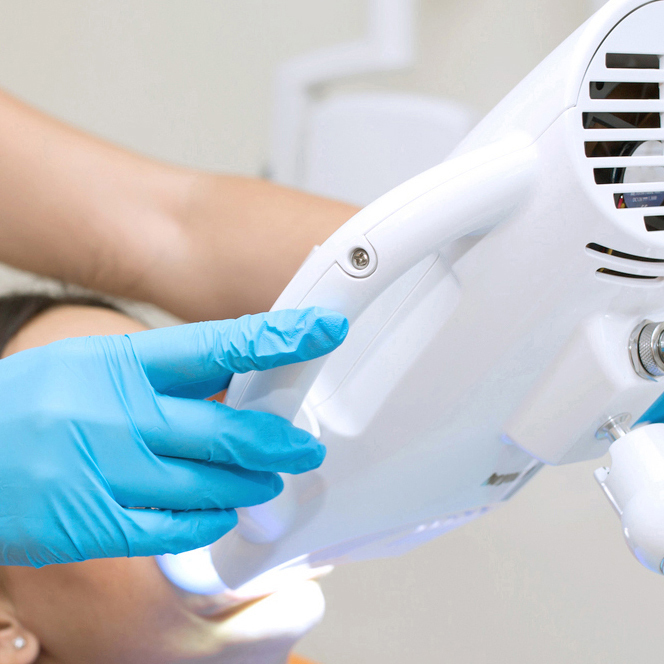 恵庭市のホワイトニング