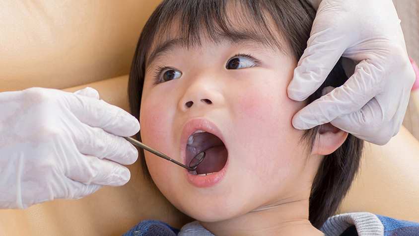 恵庭市の小児歯科