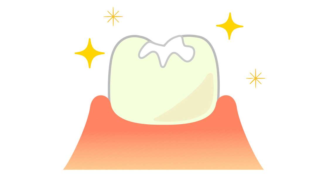 恵庭市の小児歯科