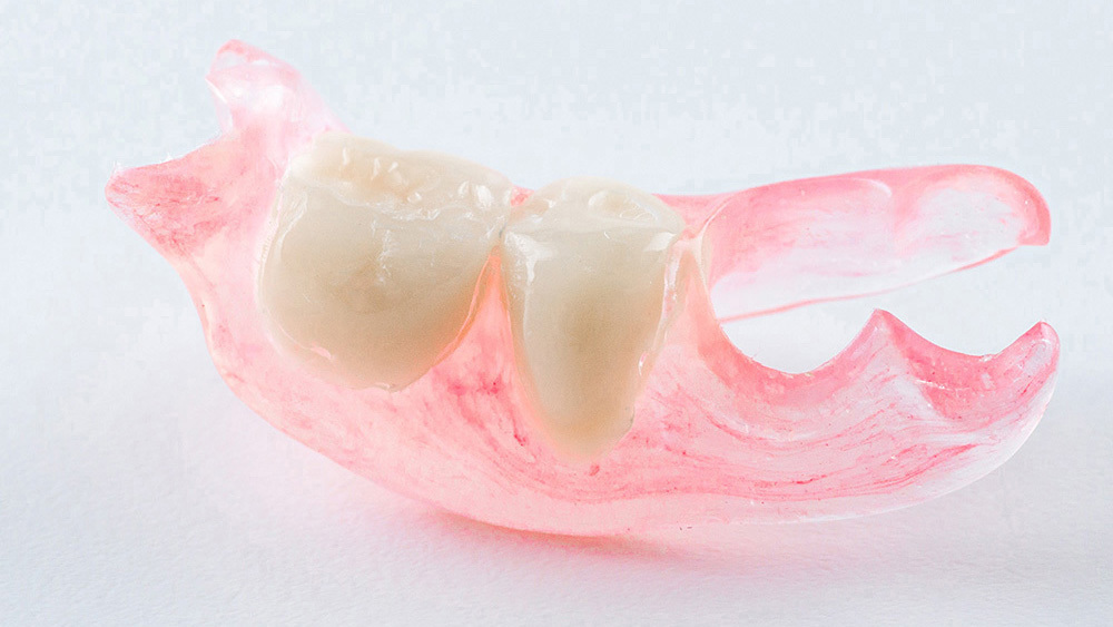 恵庭市の入れ歯の治療