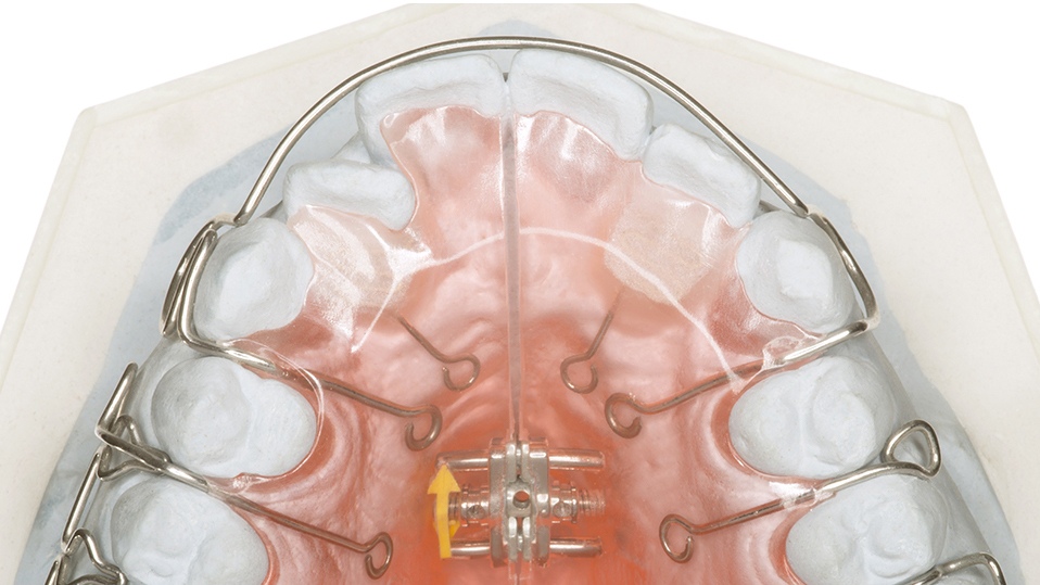 恵庭市の矯正歯科