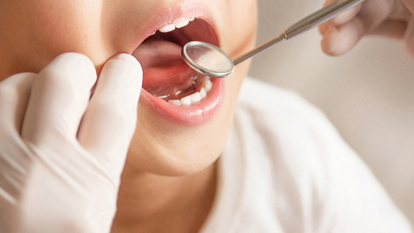 恵庭市の小児矯正