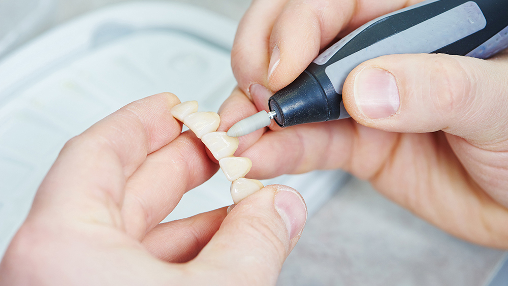 恵庭市の審美歯科(白い詰め物・被せ物)