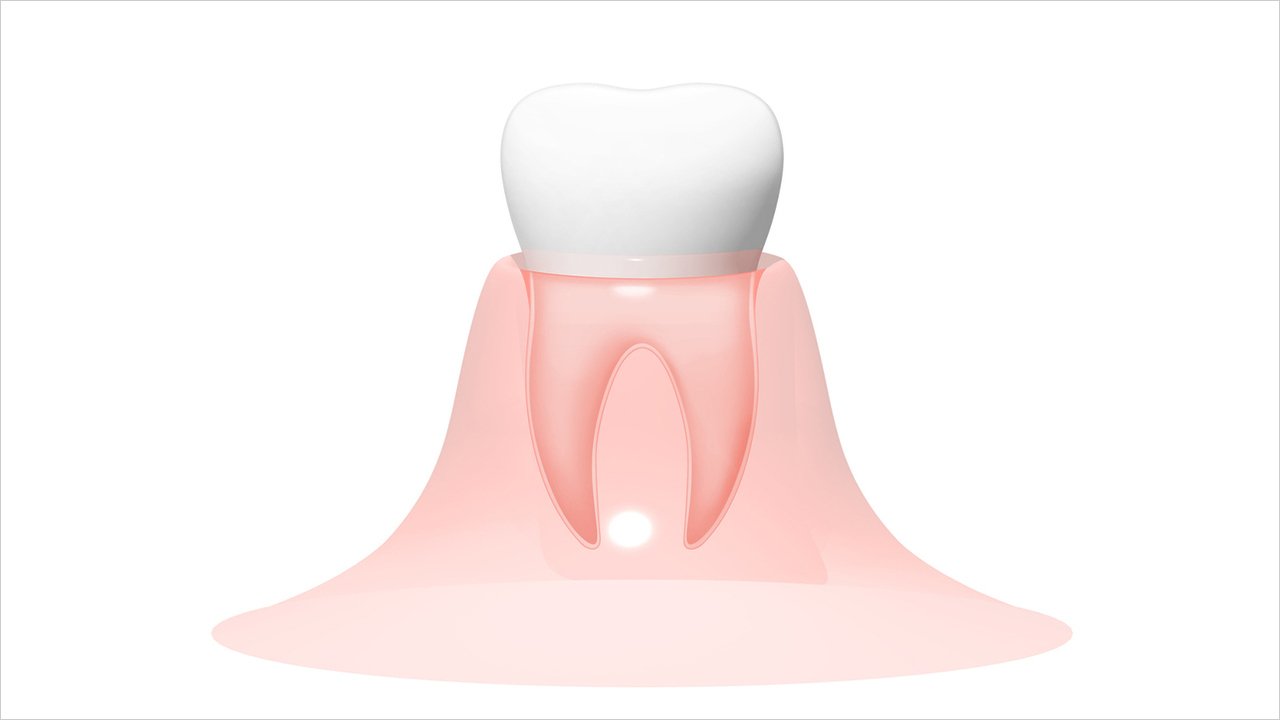 恵庭市のホワイトニング