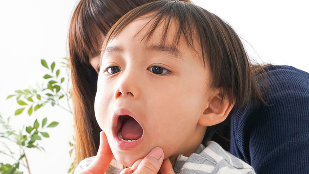 恵庭市の小児矯正