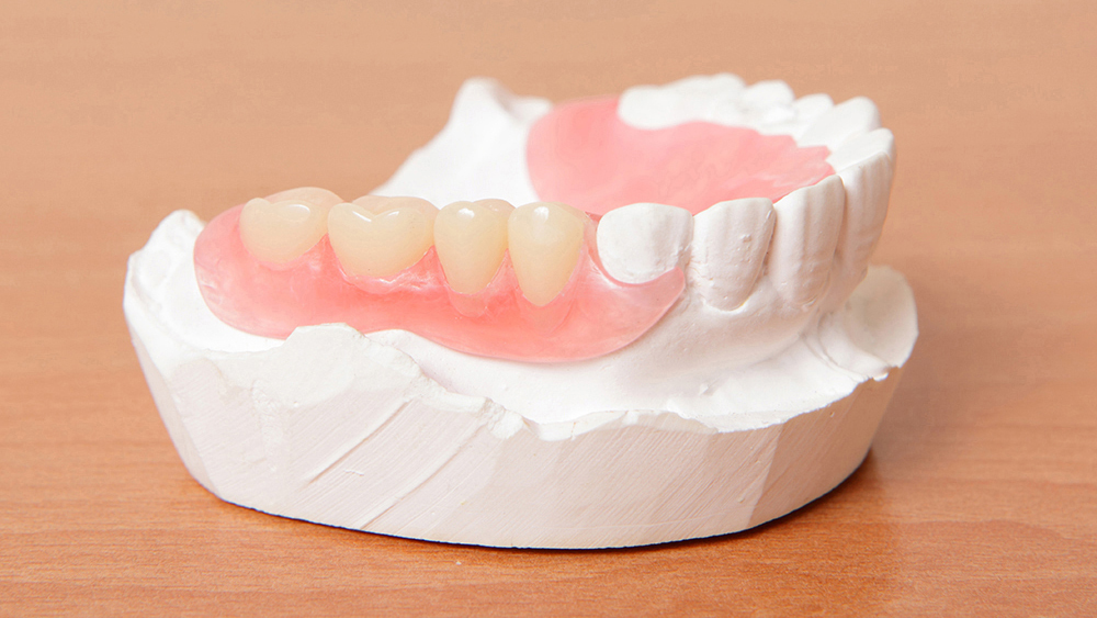 恵庭市の入れ歯の治療