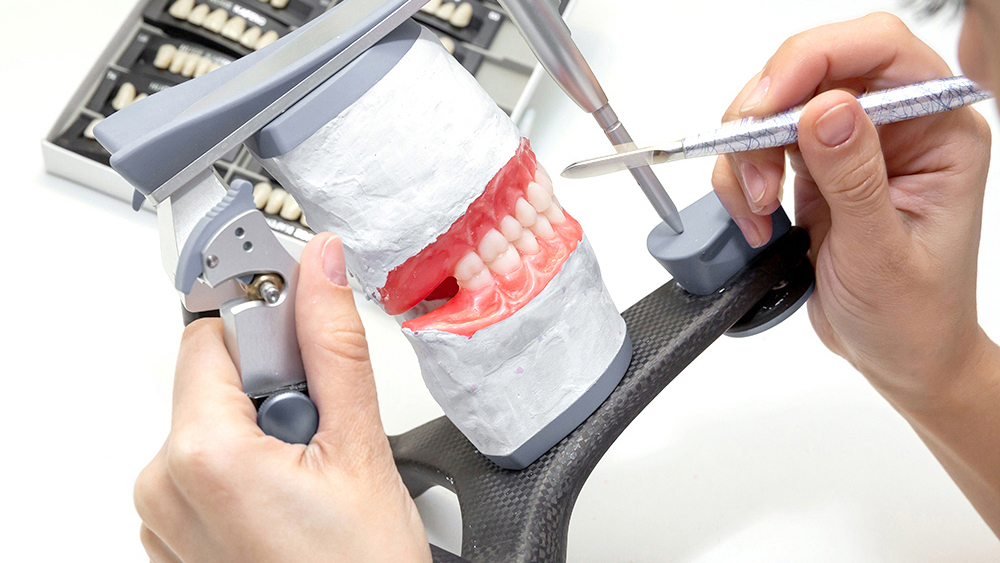 恵庭市の入れ歯の治療
