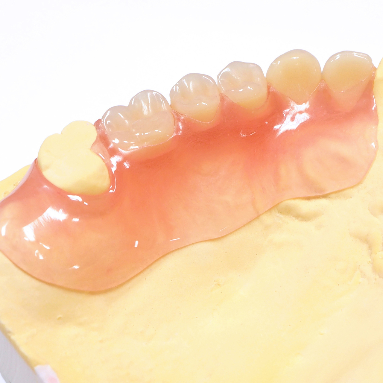 恵庭市の入れ歯の治療