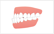 恵庭市のライオン歯科クリニックの矯正歯科