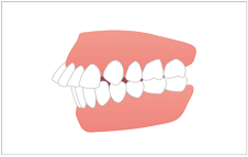 恵庭市のライオン歯科クリニックの矯正歯科