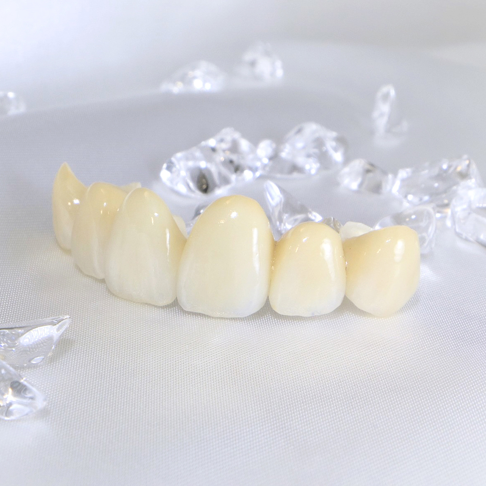 恵庭市の審美歯科(白い詰め物・被せ物)
