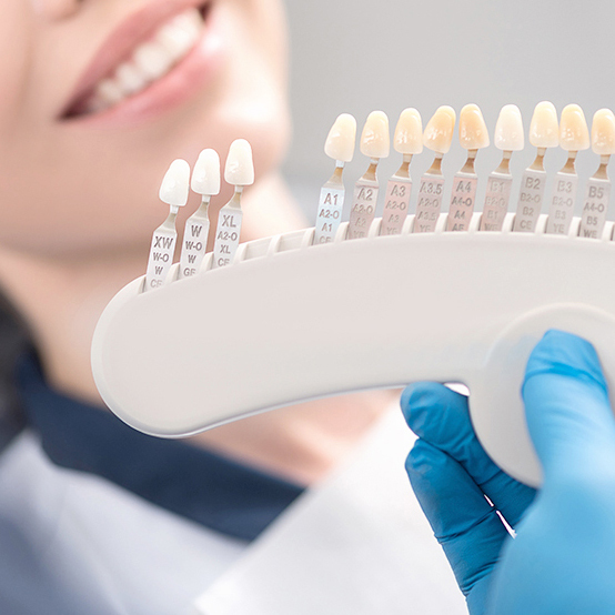 恵庭市のホワイトニング