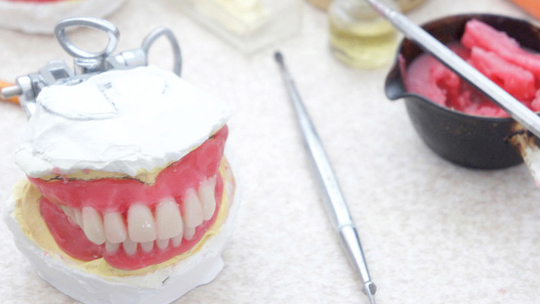 恵庭市の入れ歯の治療