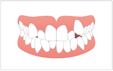 恵庭市のライオン歯科クリニックの矯正歯科