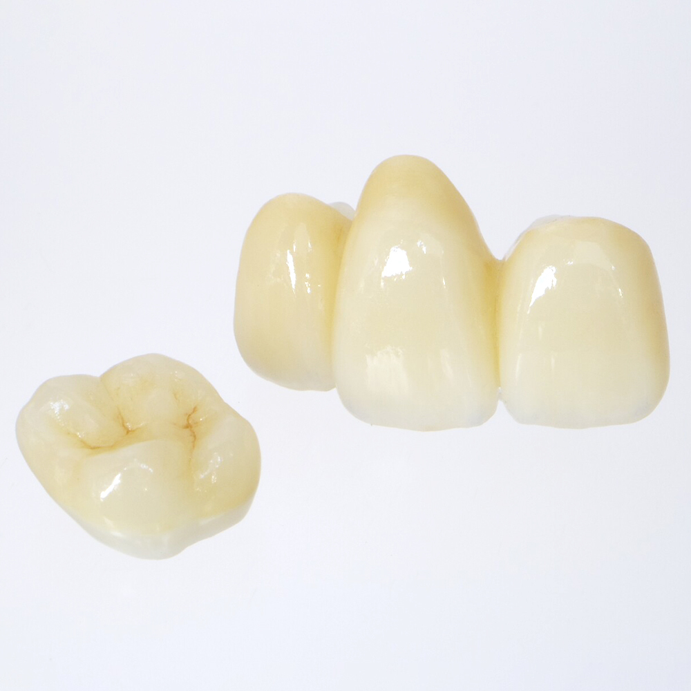 恵庭市の審美歯科(白い詰め物・被せ物)